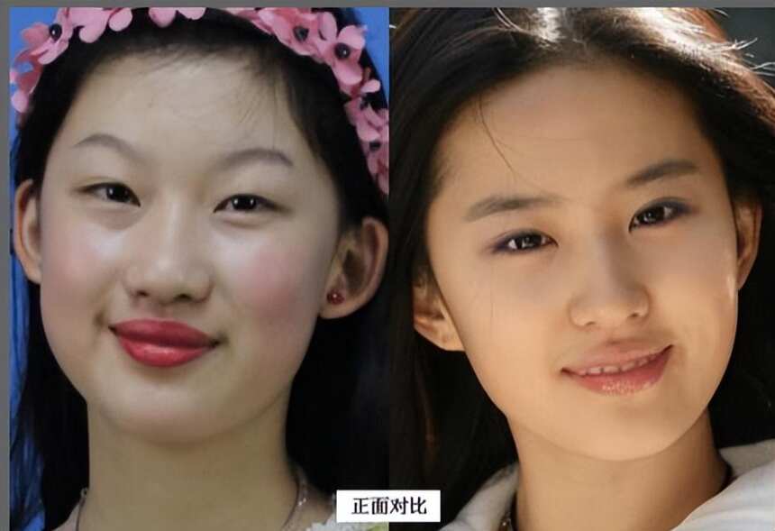 7年前，那个把自己整容成“刘亦菲”的女孩，后来怎么样了？